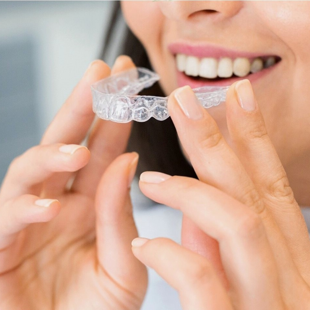 Invisalign – blog – Ortodent
