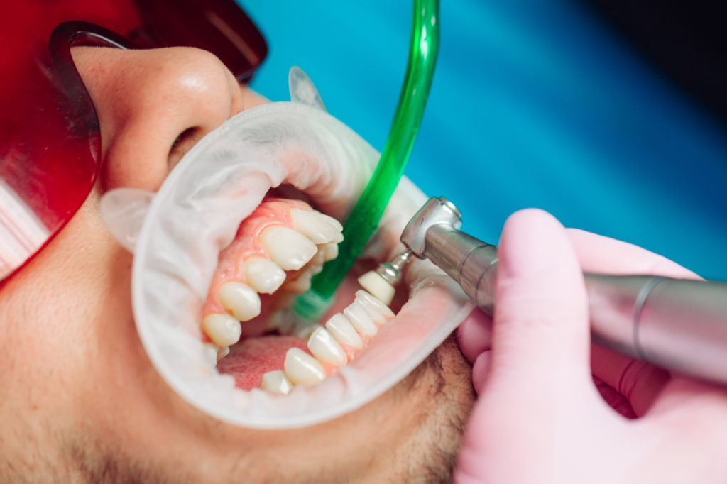 Redni zobozdravstveni pregledi – blog – Ortodent