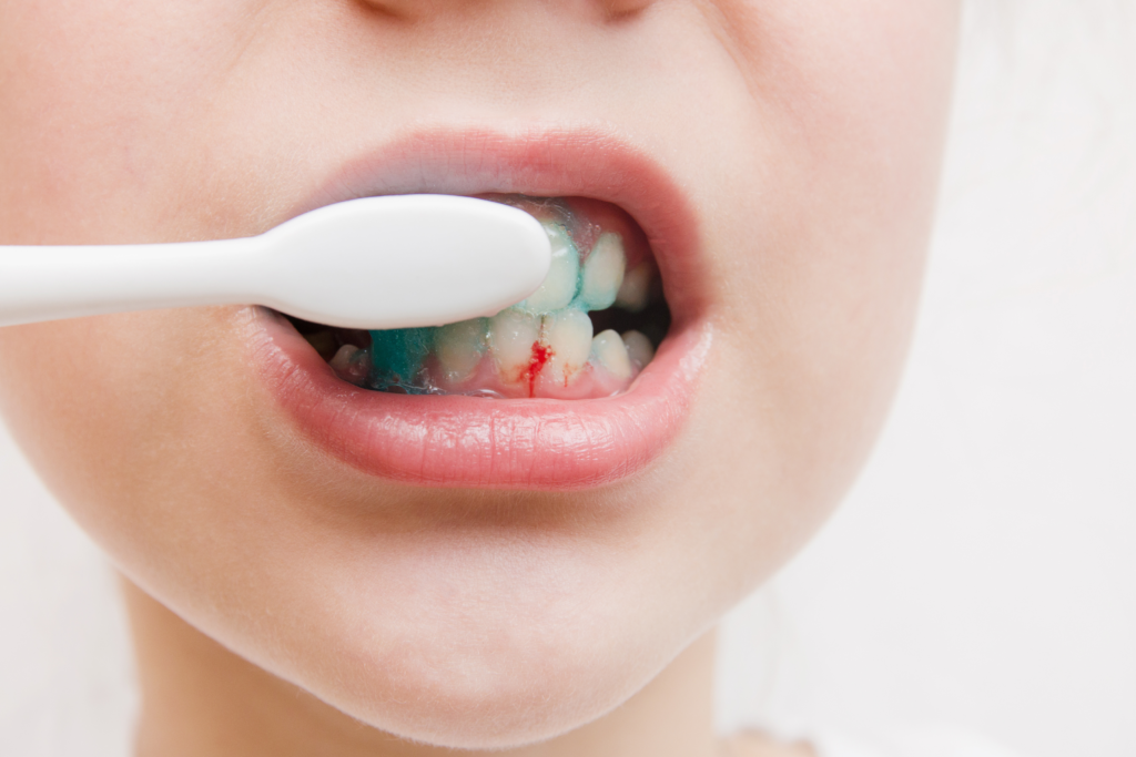 težave z dlesnimi - blog Ortodent