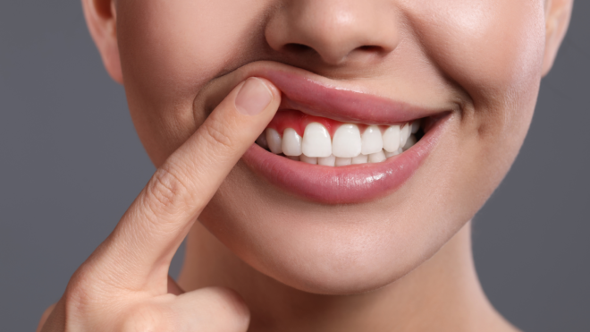 Kako prepoznati in preprečiti težave z dlesnimi?