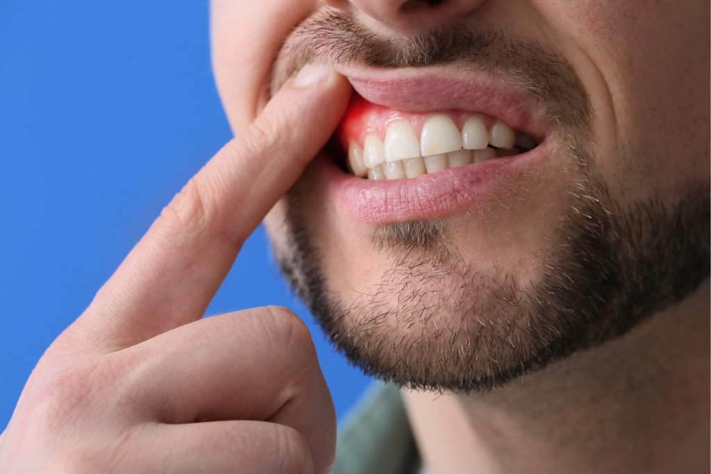 Povezava med ustno higieno in splošnim zdravjem - blog Ortodent